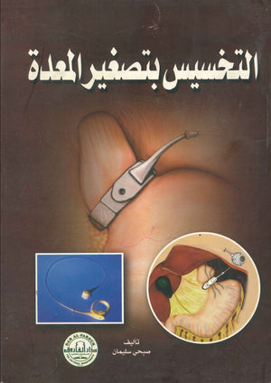 التخسيس بتصغير المعدة صبحي سليمان BookBuzz.Store